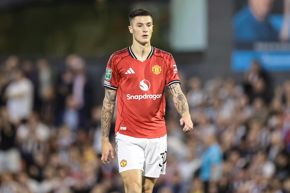 Benjamin Sesko, Manchester United